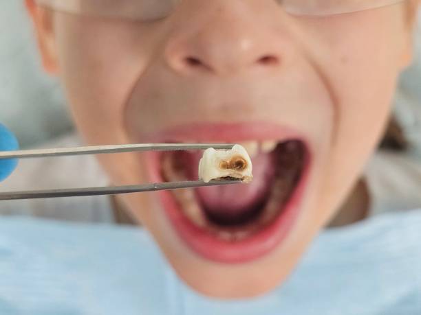 Best Emergency Cosmetic Dentistry in Fairview, CA