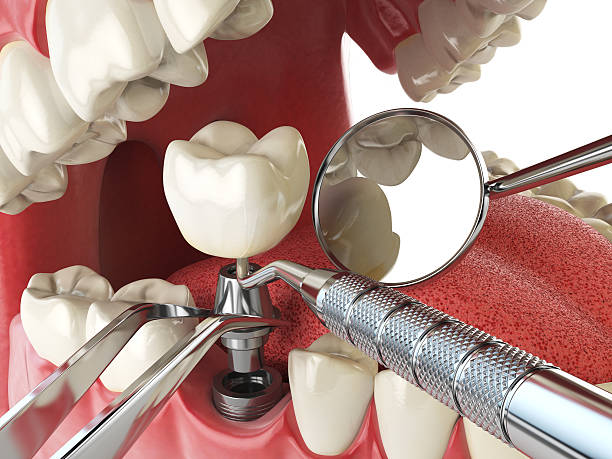 Best Mobile Emergency Dentist in Fairview, CA