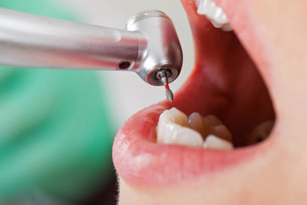 Best Emergency Dentist for Knocked-Out Tooth in Fairview, CA
